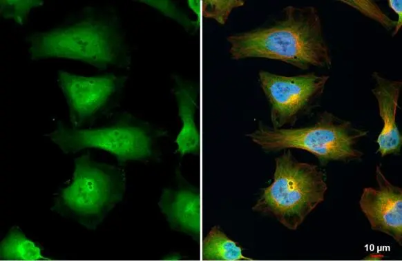 EIF5A antibody detects EIF5A protein at cytoplasm and nucleus by immunofluorescent analysis. Sample: HeLa cells were fixed in 4% paraformaldehyde at RT for 15 min. Green: EIF5A stained by EIF5A antibody (GTX111013) diluted at 1:500. Red: alpha Tubulin, a cytoskeleton marker, stained by alpha Tubulin antibody [GT114] (GTX628802) diluted at 1:1000. Blue: Fluoroshield with DAPI (GTX30920).
