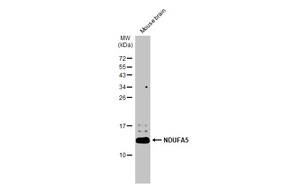 Mouse tissue extract (50 μg) was separated by 15% SDS-PAGE, and the membrane was blotted with NDUFA5 antibody [N1C3] (GTX111016) diluted at 1:1000. The HRP-conjugated anti-rabbit IgG antibody (GTX213110-01) was used to detect the primary antibody.