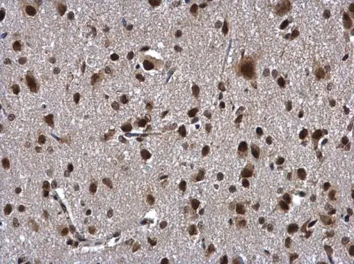 ZNF346 antibody [N1C3] detects ZNF346 protein at cytoplasm and nucleus in rat brain by immunohistochemical analysis. Sample: Paraffin-embedded rat brain. ZNF346 antibody [N1C3] (GTX111035) diluted at 1:500. 
 Antigen Retrieval: Citrate buffer, pH 6.0, 15 min