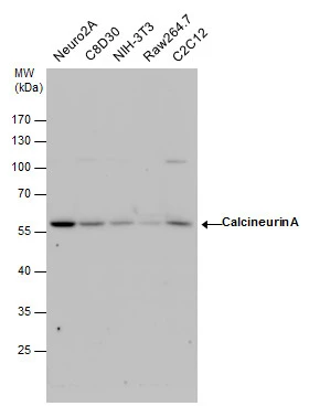 Calcineurin A antibody detects Calcineurin A protein by western blot analysis. Whole cell extracts (30 ug) was separated by 7.5 % SDS-PAGE,and blotted with Calcineurin A antibody (GTX111039) diluted by 1:3000