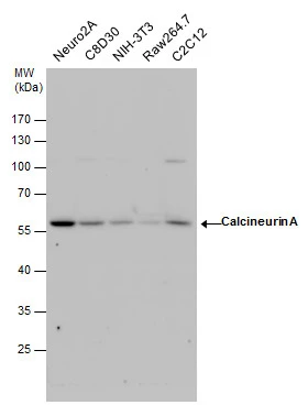 Calcineurin A antibody detects Calcineurin A protein by western blot analysis. Various whole cell extracts (30 μg) were separated by 10% SDS-PAGE, and the membrane was blotted with Calcineurin A antibody (GTX111039) diluted by 1:3000.