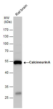 Calcineurin A antibody detects Calcineurin A protein by western blot analysis. Rat tissue extracts (50 μg) was separated by 10 % SDS-PAGE, and the membrane was blotted with Calcineurin A antibody (GTX111039) diluted by 1:3000.