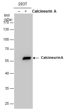 Calcineurin A antibody detects Calcineurin A protein by western blot analysis. Non-transfected (-) and Calcineurin A-transfected (+, ) 293T whole cell extracts (30 μg) were separated by 10% SDS-PAGE, and the membrane was blotted with Calcineurin A antibody (GTX111039) at a dilution of 1:5000.