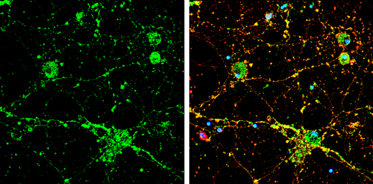 Calcineurin A antibody detects Calcineurin A protein by immunofluorescent analysis. Sample: DIV9 rat E18 primary cortical neuron cells were fixed in 4% paraformaldehyde at RT for 15 min. Green: Calcineurin A stained by Calcineurin A antibody (GTX111039) diluted at 1:500. Red: beta Tubulin 3/ Tuj1, stained by beta Tubulin 3/ Tuj1 antibody [GT1338] (GTX631831) diluted at 1:500. Blue: Fluoroshield with DAPI (GTX30920).