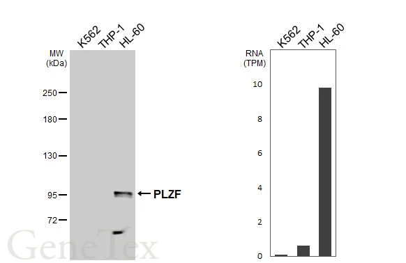 Various whole cell extracts (30 μg) were separated by 5% SDS-PAGE, and the membrane was blotted with PLZF antibody [N1N3] (GTX111046) diluted at 1:2000. The HRP-conjugated anti-rabbit IgG antibody (GTX213110-01) was used to detect the primary antibody. Corresponding RNA expression data are based on Human Protein Atlas program.