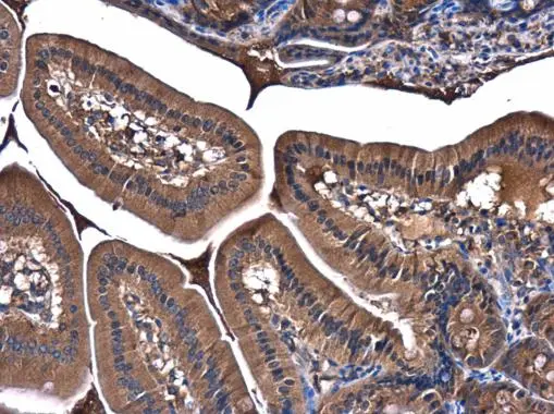 PI3 kinase p85 alpha antibody [N2C1], Internal detects PIK3R1 protein at cytoplasm in mouse duodenum by immunohistochemical analysis. Sample: Paraffin-embedded mouse duodenum. PI3 kinase p85 alpha antibody [N2C1], Internal (GTX111068) diluted at 1:500. 
 Antigen Retrieval: Citrate buffer, pH 6.0, 15 min