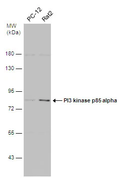 Various whole cell extracts (30 μg) were separated by 7.5% SDS-PAGE, and the membrane was blotted with PI3 kinase p85 alpha antibody [N2C1], Internal (GTX111068) diluted at 1:1000. The HRP-conjugated anti-rabbit IgG antibody (GTX213110-01) was used to detect the primary antibody.