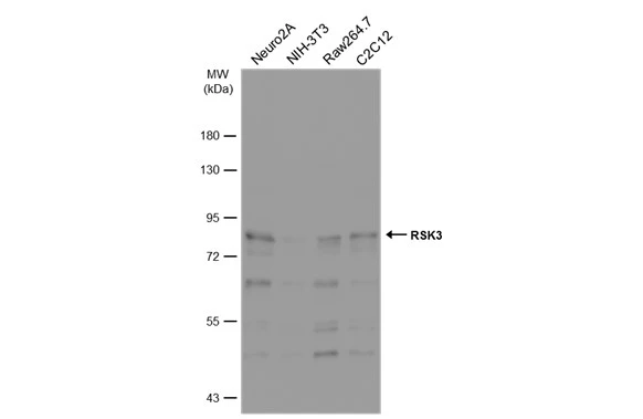 Various whole cell extracts (30 μg) were separated by 7.5% SDS-PAGE, and the membrane was blotted with RSK3 antibody [N2C1], Internal (GTX111071) diluted at 1:1000. The HRP-conjugated anti-rabbit IgG antibody (GTX213110-01) was used to detect the primary antibody.