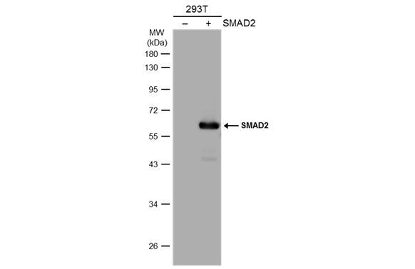 Non-transfected (–) and transfected (+) 293T whole cell extracts (30 μg) were separated by 10% SDS-PAGE, and the membrane was blotted with SMAD2 antibody (GTX111075) diluted at 1:1000. The HRP-conjugated anti-rabbit IgG antibody (GTX213110-01) was used to detect the primary antibody.
