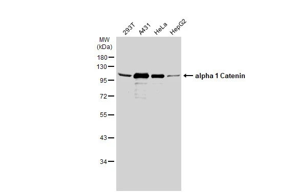 alpha 1 Catenin antibody [N3C2],Internal detects alpha 1 Catenin protein at membrane on mouse intestine by immunohistochemical analysis.
