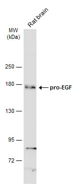 Rat tissue extract (50 μg) was separated by 5% SDS-PAGE, and the membrane was blotted with pro-EGF antibody [N3C1], Internal (GTX111099) diluted at 1:500. The HRP-conjugated anti-rabbit IgG antibody (GTX213110-01) was used to detect the primary antibody.