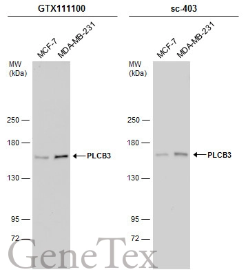 Various whole cell extracts (30 μg) were separated by 5% SDS-PAGE, and the membranes were blotted with PLCB3 antibody (GTX111100) diluted at 1:1000 and competitor's antibody (sc-403) diluted at 1:1000. The HRP-conjugated anti-rabbit IgG antibody (GTX213110-01) was used to detect the primary antibody.