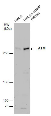 ATM antibody detects ATM protein by western blot analysis. whole cell extracts and extracts (30 μg) were separated by 5% SDS-PAGE, and the membrane was blotted with ATM antibody (GTX111106) at a dilution of 1:500.