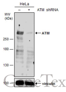 Non-transfected (–) and transfected (+) HeLa whole cell extracts (60 μg) were separated by 5% SDS-PAGE, and the membrane was blotted with ATM antibody (GTX111106) diluted at 1:500.
