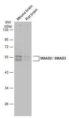 Various tissue extracts (50 μg) were separated by 10% SDS-PAGE, and the membrane was blotted with SMAD2 / SMAD3 antibody (GTX111123) diluted at 1:5000. The HRP-conjugated anti-rabbit IgG antibody (GTX213110-01) was used to detect the primary antibody. Various tissue extracts (50 μg) were separated by 10% SDS-PAGE, and the membrane was blotted with SMAD2 / SMAD3 antibody (GTX111123) diluted at 1:5000. The HRP-conjugated anti-rabbit IgG antibody (GTX213110-01) was used to detect the primary antibody.