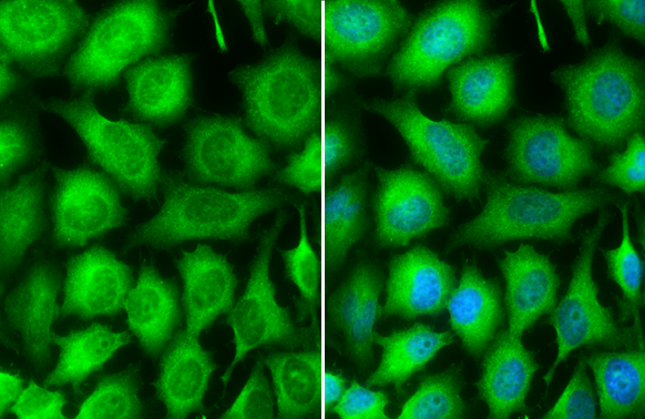 TRAF2 antibody detects TRAF2 protein at cytoplasm by immunofluorescent analysis. Sample: HeLa cells were fixed in 4% paraformaldehyde at RT for 15 min. Green: TRAF2 stained by TRAF2 antibody (GTX111138) diluted at 1:500. Blue: Fluoroshield with DAPI (GTX30920).