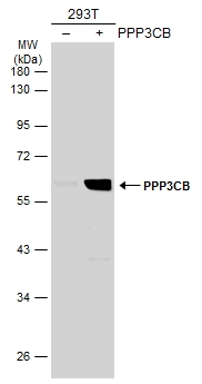 Non-transfected (–) and transfected (+) 293T whole cell extracts (30 μg) were separated by 10% SDS-PAGE, and the membrane was blotted with PPP3CB antibody [N1N3] (GTX111141) diluted at 1:1000. The HRP-conjugated anti-rabbit IgG antibody (GTX213110-01) was used to detect the primary antibody.