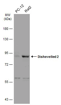 Various whole cell extracts (30 μg) were separated by 7.5% SDS-PAGE, and the membrane was blotted with Dishevelled 2 antibody [N1N3] (GTX111156) diluted at 1:5000. The HRP-conjugated anti-rabbit IgG antibody (GTX213110-01) was used to detect the primary antibody.