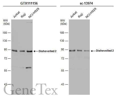 Various whole cell extracts (30 μg) were separated by 7.5% SDS-PAGE, and the membranes were blotted with Dishevelled 2 antibody [N1N3] (GTX111156) diluted at 1:10000 and competitor's antibody (sc-13974) diluted at 1:1000. The HRP-conjugated anti-rabbit IgG antibody (GTX213110-01) was used to detect the primary antibody.