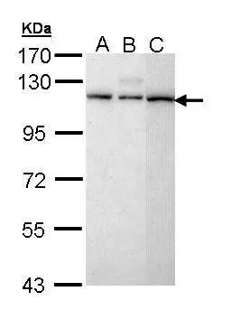 Sample (30 ug of whole cell lysate) A: H1299 B: Hela C: Molt-4 (GTX27912) 7.5% SDS PAGE GTX111158 diluted at 1:5000 
