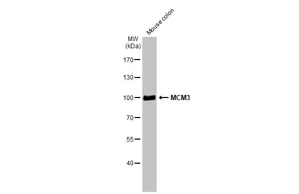 Mouse tissue extract (50 μg) was separated by 7.5% SDS-PAGE, and the membrane was blotted with MCM3 antibody [N1N3] (GTX111160) diluted at 1:500. The HRP-conjugated anti-rabbit IgG antibody (GTX213110-01) was used to detect the primary antibody.