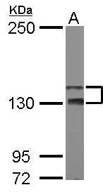 Sample (50 ug of whole cell lysate) A: mouse brain 5% SDS PAGE GTX111170 diluted at 1:1000
