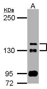 Sample (50 ug of whole cell lysate) A: mouse brain 5% SDS PAGE GTX111171 diluted at 1:1000