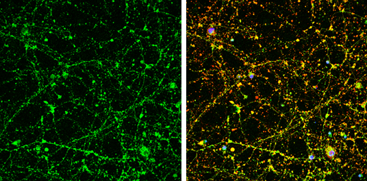 UNC13B antibody [N3C1], Internal detects UNC13B protein by immunofluorescent analysis. Sample: DIV9 rat E18 primary cortical neuron cells were fixed in 4% paraformaldehyde at RT for 15 min. Green: UNC13B stained by UNC13B antibody [N3C1], Internal (GTX111179) diluted at 1:500. Red: beta Tubulin 3/ Tuj1, stained by beta Tubulin 3/ Tuj1 antibody [GT1338] (GTX631831) diluted at 1:500. Blue: Fluoroshield with DAPI (GTX30920).