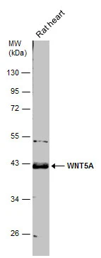 Rat tissue extract (50 μg) was separated by 10% SDS-PAGE, and the membrane was blotted with WNT5A antibody (GTX111187) diluted at 1:500. Rat tissue extract (50 μg) was separated by 10% SDS-PAGE, and the membrane was blotted with WNT5A antibody (GTX111187) diluted at 1:500.