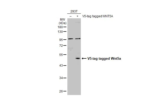 Non-transfected (–) and transfected (+) 293T whole cell extracts (30 μg) were separated by 10% SDS-PAGE, and the membrane was blotted with Wnt5a antibody (GTX111187) diluted at 1:5000. The HRP-conjugated anti-rabbit IgG antibody (GTX213110-01) was used to detect the primary antibody, and the signal was developed with Trident ECL plus-Enhanced. Non-transfected (–) and transfected (+) 293T whole cell extracts (30 μg) were separated by 10% SDS-PAGE, and the membrane was blotted with Wnt5a antibody (GTX111187) diluted at 1:5000. The HRP-conjugated anti-rabbit IgG antibody (GTX213110-01) was used to detect the primary antibody, and the signal was developed with Trident ECL plus-Enhanced.