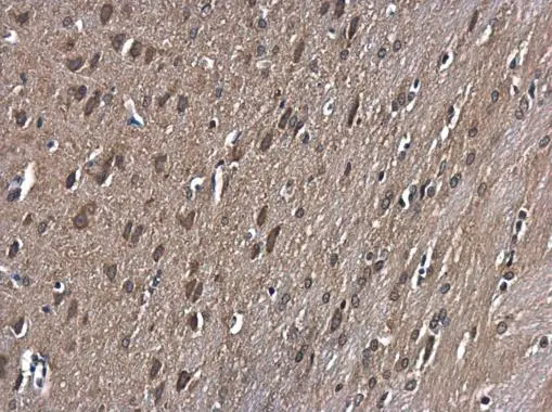 GSK3 beta antibody [C1C3] detects GSK3 beta protein at cytoplasm in rat brain by immunohistochemical analysis. Sample: Paraffin-embedded rat brain. GSK3 beta antibody [C1C3] (GTX111192) diluted at 1:500. 
 Antigen Retrieval: Citrate buffer, pH 6.0, 15 min