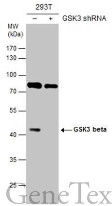 Non-transfected (–) and transfected (+) 293T whole cell extracts (30 μg) were separated by 10% SDS-PAGE, and the membrane was blotted with GSK3 beta antibody [C1C3] (GTX111192) diluted at 1:1000. The HRP-conjugated anti-rabbit IgG antibody (GTX213110-01) was used to detect the primary antibody.