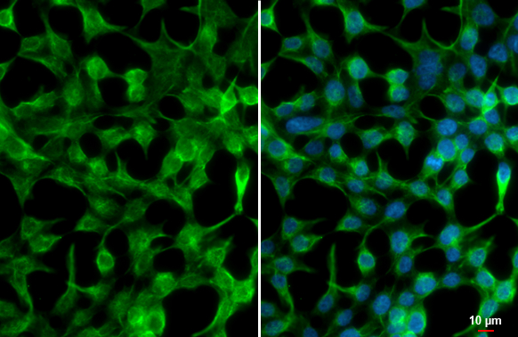 GSK3 beta antibody [C1C3] detects GSK3 beta protein at cytoplasm and cell membrane by immunofluorescent analysis. Sample: HeLa cells were fixed in 4% paraformaldehyde at RT for 15 min. Green: GSK3 beta stained by GSK3 beta antibody [C1C3] (GTX111192) diluted at 1:500. Blue: Fluoroshield with DAPI (GTX30920). Scale bar= 10μm.