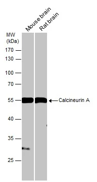 Various tissue extracts (50 μg) were separated by 10% SDS-PAGE, and the membrane was blotted with Calcineurin A antibody (GTX111207) diluted at 1:1000.