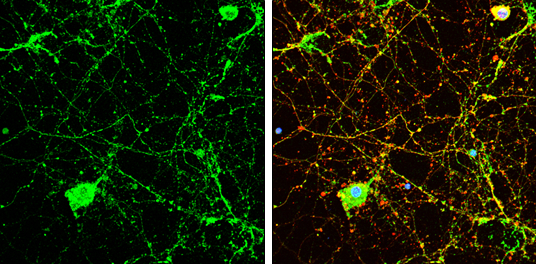Calcineurin A antibody detects Calcineurin A protein by immunofluorescent analysis. Sample: DIV9 rat E18 primary cortical neuron cells were fixed in 4% paraformaldehyde at RT for 15 min. Green: Calcineurin A stained by Calcineurin A antibody (GTX111207) diluted at 1:500. Red: beta Tubulin 3/ Tuj1, stained by beta Tubulin 3/ Tuj1 antibody [GT1338] (GTX631831) diluted at 1:500. Blue: Fluoroshield with DAPI (GTX30920).