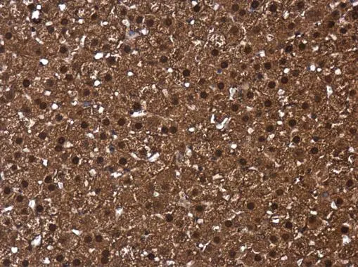 CIAPIN1 antibody detects CIAPIN1 protein at cytoplasm and nucleus in rat adrenal gland by immunohistochemical analysis. Sample: Paraffin-embedded rat adrenal gland. CIAPIN1 antibody (GTX111212) diluted at 1:500. 
 Antigen Retrieval: Citrate buffer, pH 6.0, 15 min