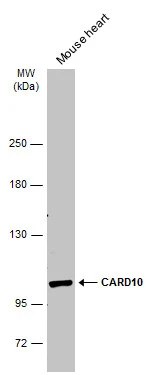 Mouse tissue extract (50 μg) was separated by 5% SDS-PAGE, and the membrane was blotted with CARD10 antibody (GTX111222) diluted at 1:500. The HRP-conjugated anti-rabbit IgG antibody (GTX213110-01) was used to detect the primary antibody, and the signal was developed with Trident ECL plus-Enhanced.