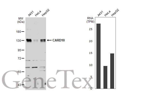 Various whole cell extracts (30 μg) were separated by 7.5% SDS-PAGE, and the membrane was blotted with CARD10 antibody [N2C1], Internal (GTX111222) diluted at 1:1000. The HRP-conjugated anti-rabbit IgG antibody (GTX213110-01) was used to detect the primary antibody. Corresponding RNA expression data for the same cell lines are based on Human Protein Atlas program.