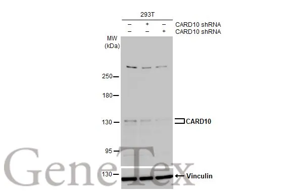 Non-transfected (–) and transfected (+) 293T whole cell extracts (30 μg) were separated by 5% SDS-PAGE, and the membrane was blotted with CARD10 antibody [N2C1], Internal (GTX111222) diluted at 1:1000. The HRP-conjugated anti-rabbit IgG antibody (GTX213110-01) was used to detect the primary antibody.
