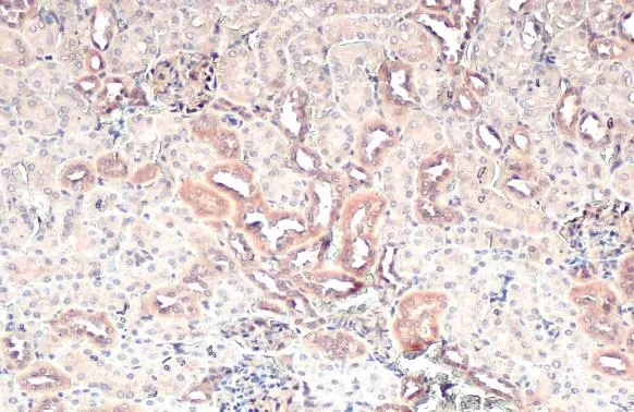 CARD10 antibody [N2C1], Internal detects CARD10 protein at cytoplasm by immunohistochemical analysis. Sample: Paraffin-embedded mouse kidney. CARD10 stained by CARD10 antibody [N2C1], Internal (GTX111222) diluted at 1:500. Antigen Retrieval: Citrate buffer, pH 6.0, 15 min