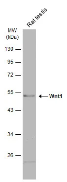 Rat tissue extract (50 μg) was separated by 10% SDS-PAGE, and the membrane was blotted with Wnt1 antibody (GTX111231) diluted at 1:1000. The HRP-conjugated anti-rabbit IgG antibody (GTX213110-01) was used to detect the primary antibody, and the signal was developed with Trident ECL plus-Enhanced.