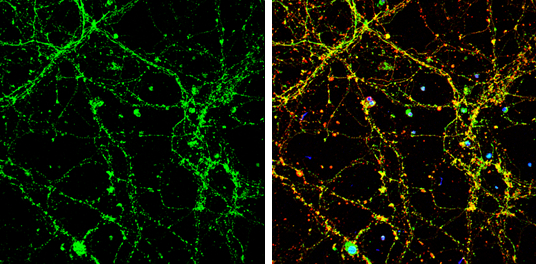 UNC13B antibody [N2N3] detects UNC13B protein by immunofluorescent analysis. Sample: DIV9 rat E18 primary cortical neuron cells were fixed in 4% paraformaldehyde at RT for 15 min. Green: UNC13B stained by UNC13B antibody [N2N3] (GTX111244) diluted at 1:500. Red: beta Tubulin 3/ Tuj1, stained by beta Tubulin 3/ Tuj1 antibody [GT1338] (GTX631831) diluted at 1:500. Blue: Fluoroshield with DAPI (GTX30920).