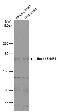 Various tissue extracts (50 μg) were separated by 5% SDS-PAGE, and the membrane was blotted with Her4 / ErbB4 antibody [C1C3] (GTX111276) diluted at 1:1000. The HRP-conjugated anti-rabbit IgG antibody (GTX213110-01) was used to detect the primary antibody.