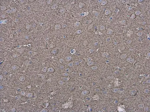 P2X7 antibody detects P2X7 protein at cell membrane and cytoplasm in mouse brain by immunohistochemical analysis. Sample: Paraffin-embedded mouse brain. P2X7 antibody (GTX111284) diluted at 1:500.
Antigen Retrieval: Citrate buffer, pH 6.0, 15 min