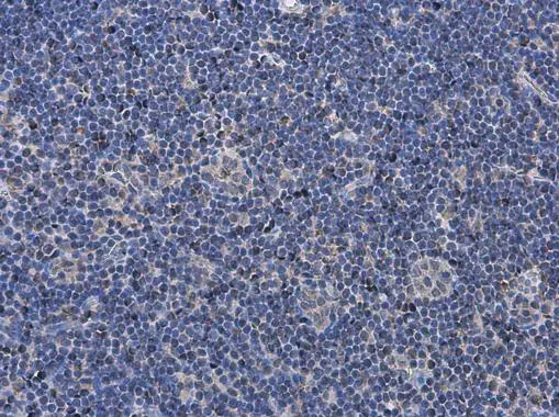 P2X7 antibody detects P2X7 protein at cell membrane and cytoplasm in rat lymph node by immunohistochemical analysis. Sample: Paraffin-embedded rat lymph node. P2X7 antibody (GTX111284) diluted at 1:500. 
 Antigen Retrieval: Citrate buffer, pH 6.0, 15 min