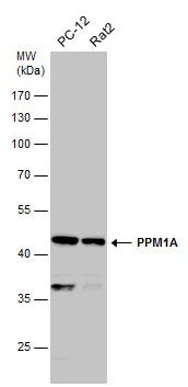 Various whole cell extracts (30 μg) were separated by 10% SDS-PAGE, and the membrane was blotted with PPM1A antibody (GTX111288) diluted at 1:500.