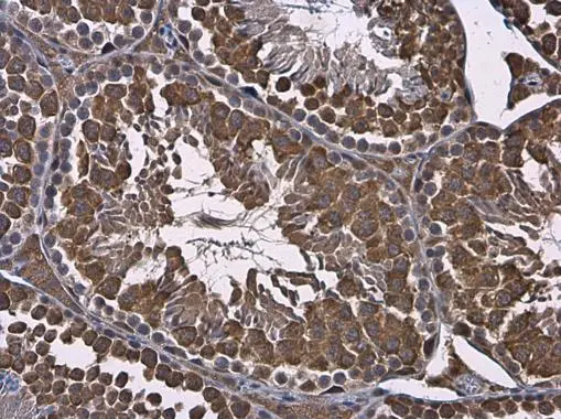 RUVBL1 antibody detects RUVBL1 protein at cytoplasm in mouse testis by immunohistochemical analysis. Sample: Paraffin-embedded mouse testis. RUVBL1 antibody (GTX111294) diluted at 1:500.
Antigen Retrieval: Citrate buffer, pH 6.0, 15 min RUVBL1 antibody detects RUVBL1 protein at cytoplasm in mouse testis by immunohistochemical analysis. Sample: Paraffin-embedded mouse testis. RUVBL1 antibody (GTX111294) diluted at 1:500.
Antigen Retrieval: Citrate buffer, pH 6.0, 15 min