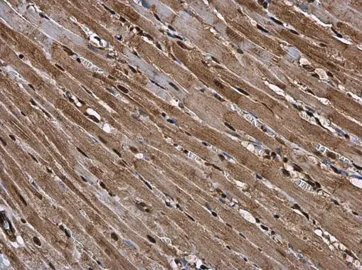 RUVBL1 antibody detects RUVBL1 protein at cytoplasm and nucleus in rat heart by immunohistochemical analysis. Sample: Paraffin-embedded rat heart. RUVBL1 antibody (GTX111294) diluted at 1:500.
Antigen Retrieval: Citrate buffer, pH 6.0, 15 min RUVBL1 antibody detects RUVBL1 protein at cytoplasm and nucleus in rat heart by immunohistochemical analysis. Sample: Paraffin-embedded rat heart. RUVBL1 antibody (GTX111294) diluted at 1:500.
Antigen Retrieval: Citrate buffer, pH 6.0, 15 min