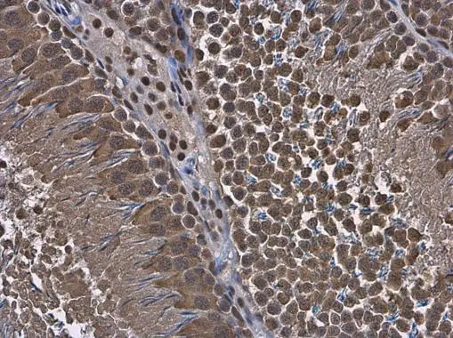 RUVBL1 antibody detects RUVBL1 protein at cytoplasm in rat testis by immunohistochemical analysis. Sample: Paraffin-embedded rat testis. RUVBL1 antibody (GTX111294) diluted at 1:500.
Antigen Retrieval: Citrate buffer, pH 6.0, 15 min RUVBL1 antibody detects RUVBL1 protein at cytoplasm in rat testis by immunohistochemical analysis. Sample: Paraffin-embedded rat testis. RUVBL1 antibody (GTX111294) diluted at 1:500.
Antigen Retrieval: Citrate buffer, pH 6.0, 15 min