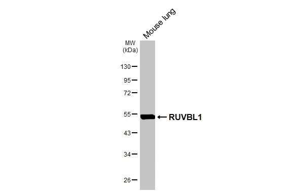 Mouse tissue extract (50 μg) was separated by 10% SDS-PAGE, and the membrane was blotted with RUVBL1 antibody (GTX111294) diluted at 1:1000. The HRP-conjugated anti-rabbit IgG antibody (GTX213110-01) was used to detect the primary antibody. Mouse tissue extract (50 μg) was separated by 10% SDS-PAGE, and the membrane was blotted with RUVBL1 antibody (GTX111294) diluted at 1:1000. The HRP-conjugated anti-rabbit IgG antibody (GTX213110-01) was used to detect the primary antibody.
